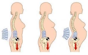 Pregnancy Back Pain 300x188