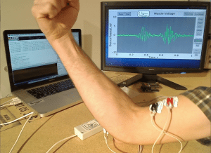 Muscles all in a knot? Chiropractic beats aches, pains and tension! EMG 300x218