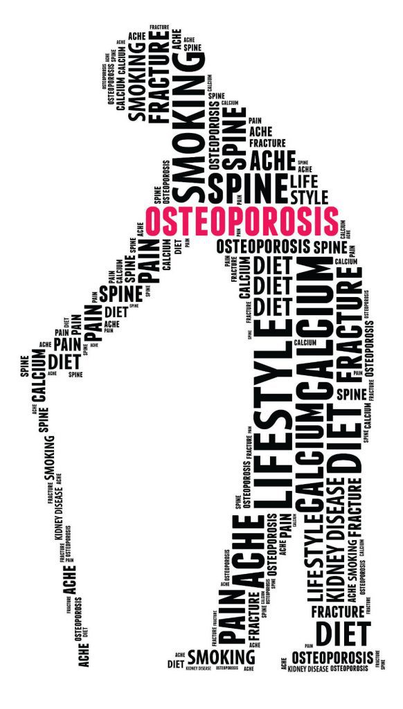 Osteoporosis – a natural approach to treatment and prevention