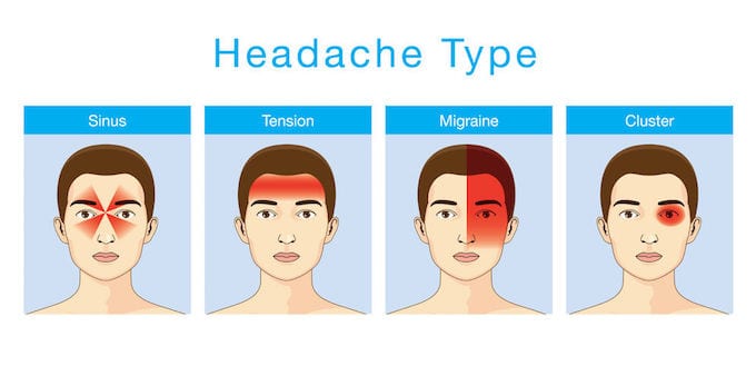 Headache Types