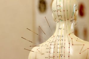 Acupuncture Chart And Meanings 300x200