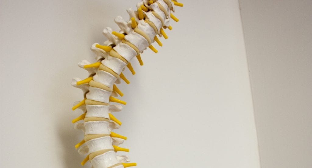 Scoli Spine2 1024x551
