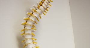 Scoli Spine2 300x161