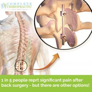 Spinal Fusion 300x300