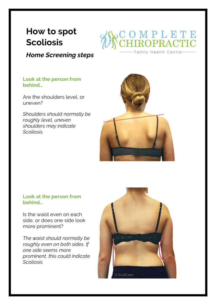 Complete Chiropractic Spot Scoli Handout 1 724x1024