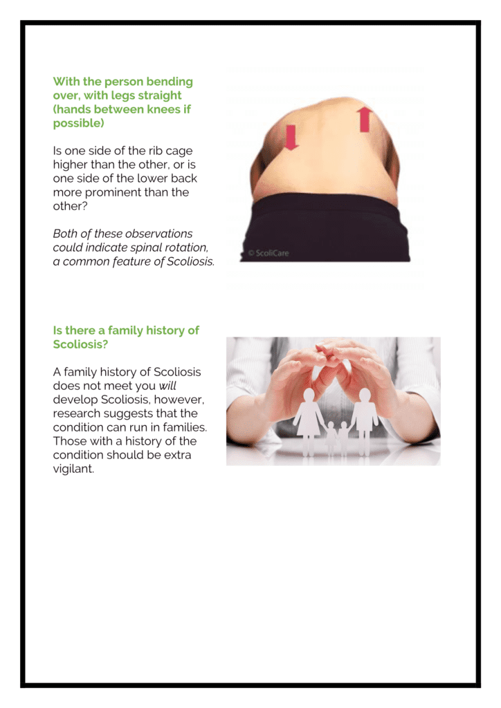 Complete Chiropractic Spot Scoli Handout 3 724x1024