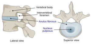 Spinal Disc Diagram 300x146